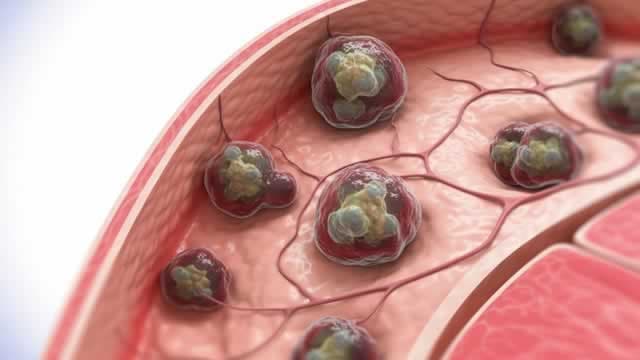 Janux dives as gaps in prostate cancer study data worry investors