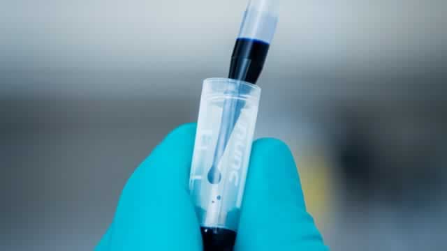 Novo Nordisk A/S (NVO) is Attracting Investor Attention: Here is What You Should Know