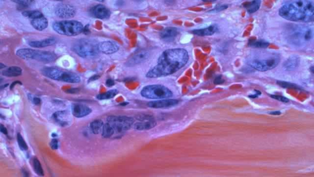 GE HealthCare Technologies Inc. (GEHC) Presents at 44th Annual J.P. Morgan Healthcare Conference Transcript